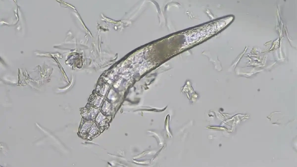 demodectic mange