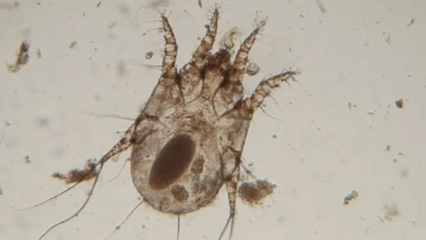 ear mites